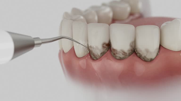Reliable Dental Implants contractor in Buttonwillow, CA by Smile Center Dentistry